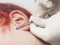 Gdzie najbardziej boli kolczyk? Odkryj najboleśniejsze miejsca na piercing