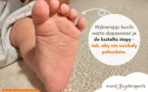 Dziecięca, szeroka stopa z widocznymi paluszkami. Tekst radzi dopasować buciki do kształtu stopy, by nie uciskały paluszków.